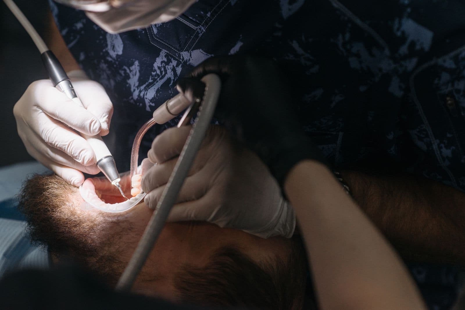Dentist performing a professional clean with an ultrasonic scaler