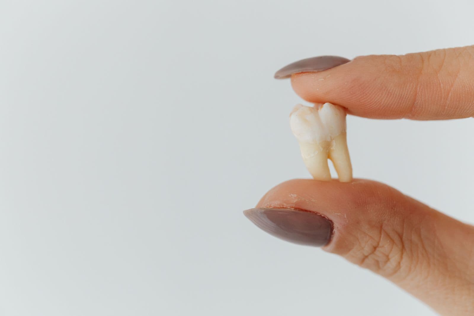 Knocked-out tooth held between fingers before urgent dental care