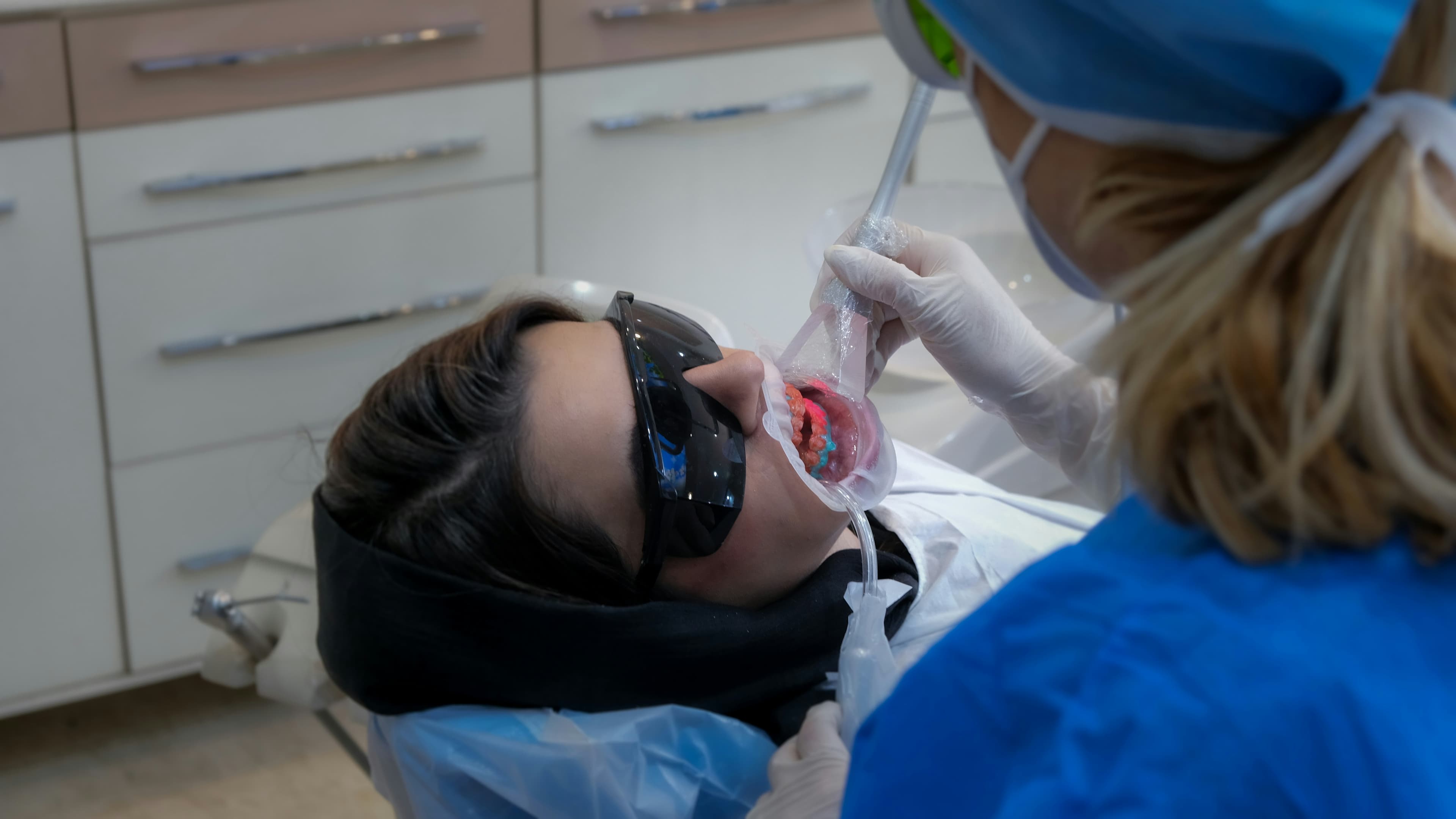 Teeth Whitening