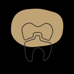 Tooth illustration