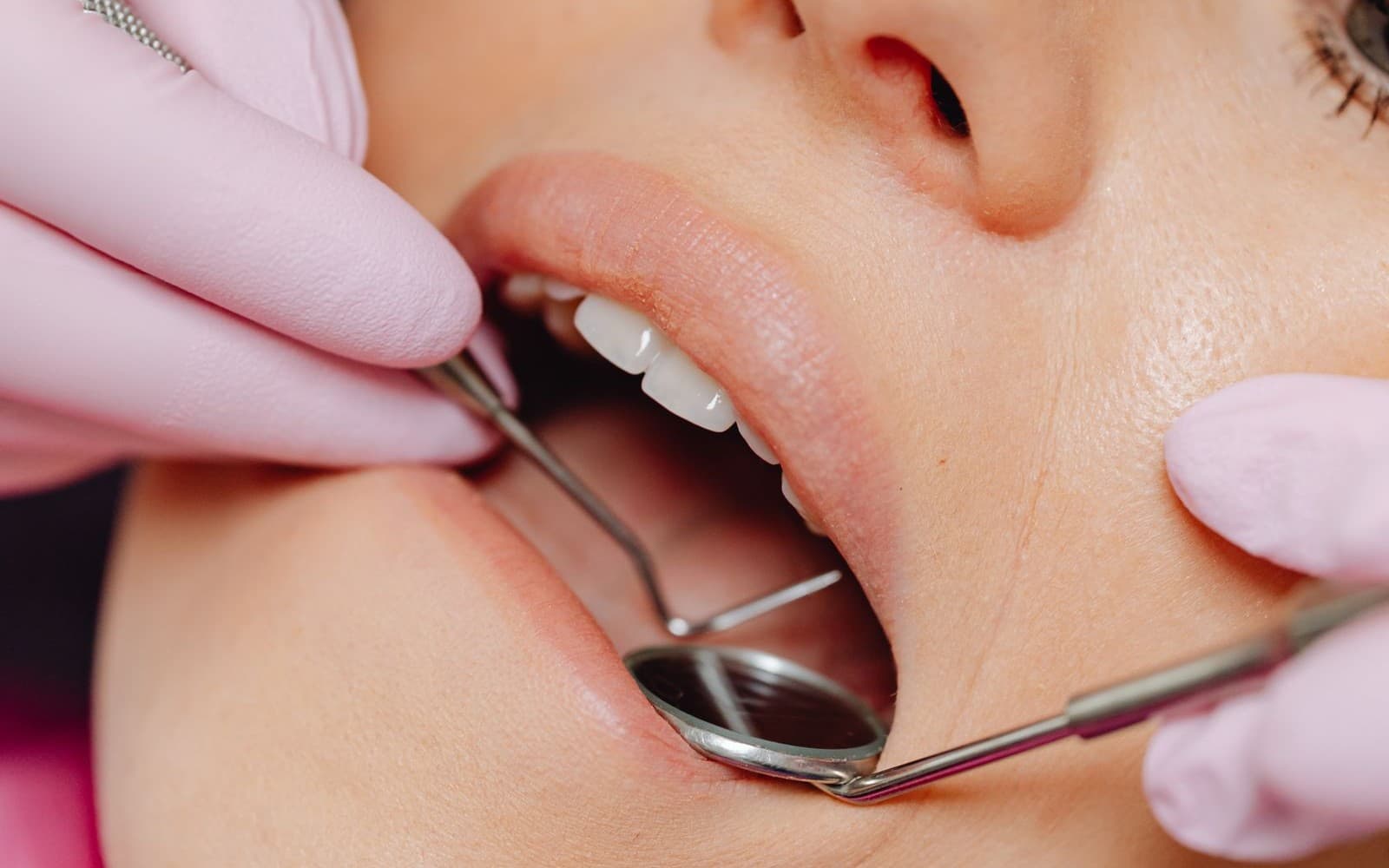 Dentist using a mirror and probe during a professional gum care visit