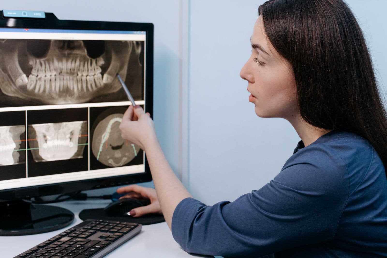 Dentist reviewing a dental X-ray on screen