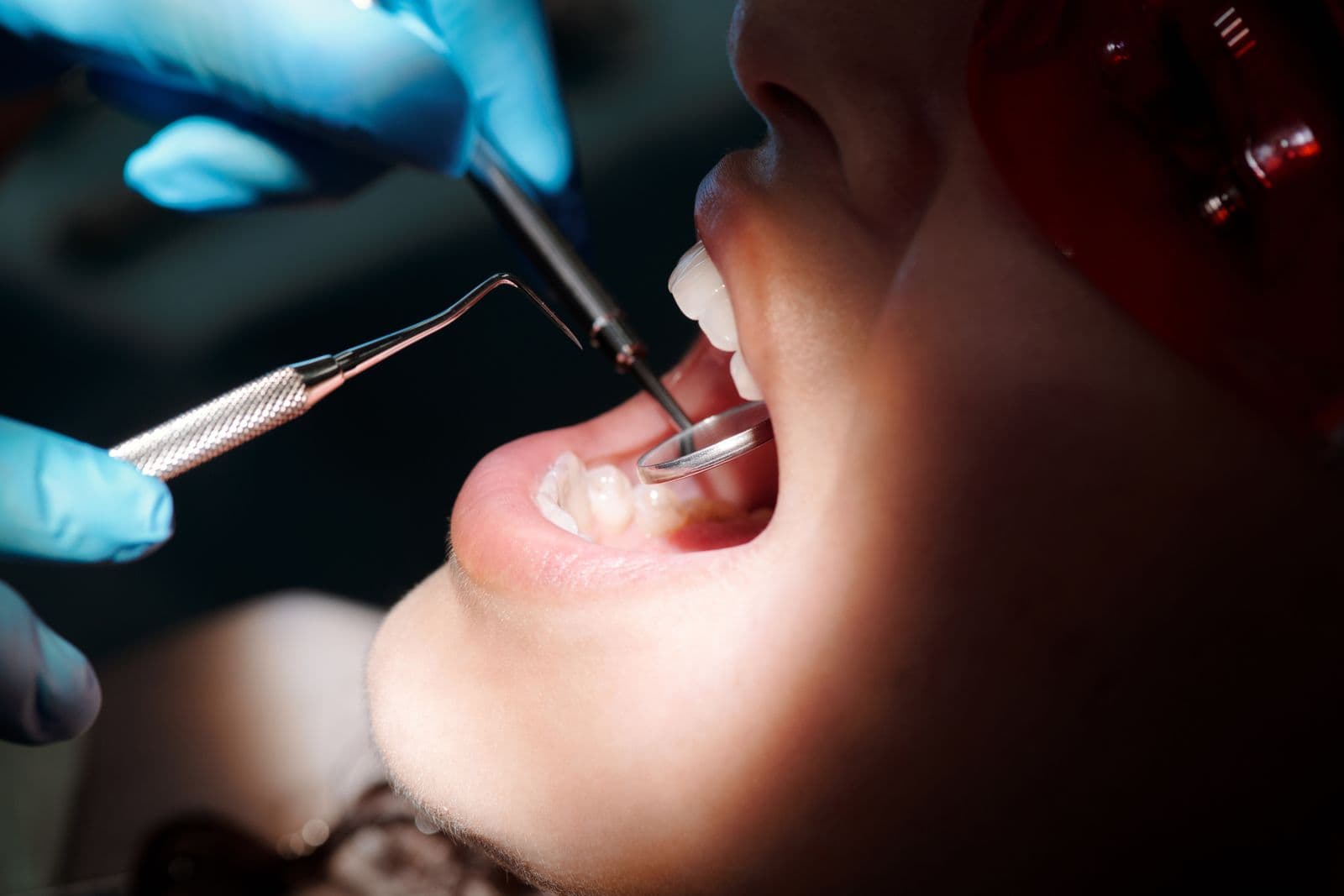 Dentist examining the back teeth with a mirror and probe