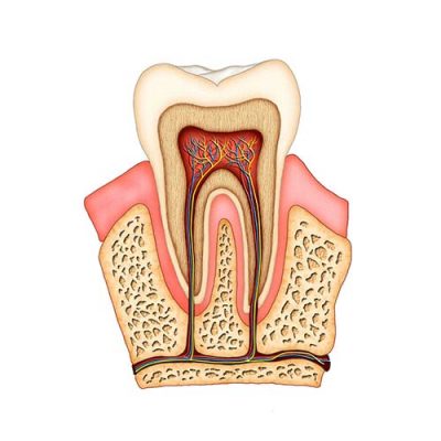 root-canal